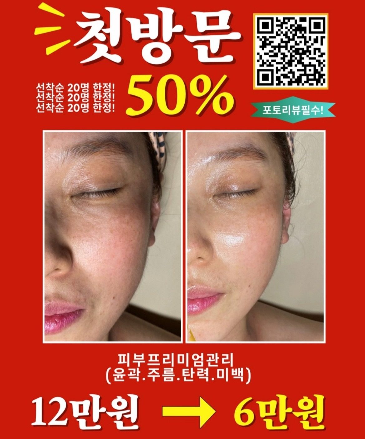 [칼 안 대고 성형효과주는 어썸웰스파]
