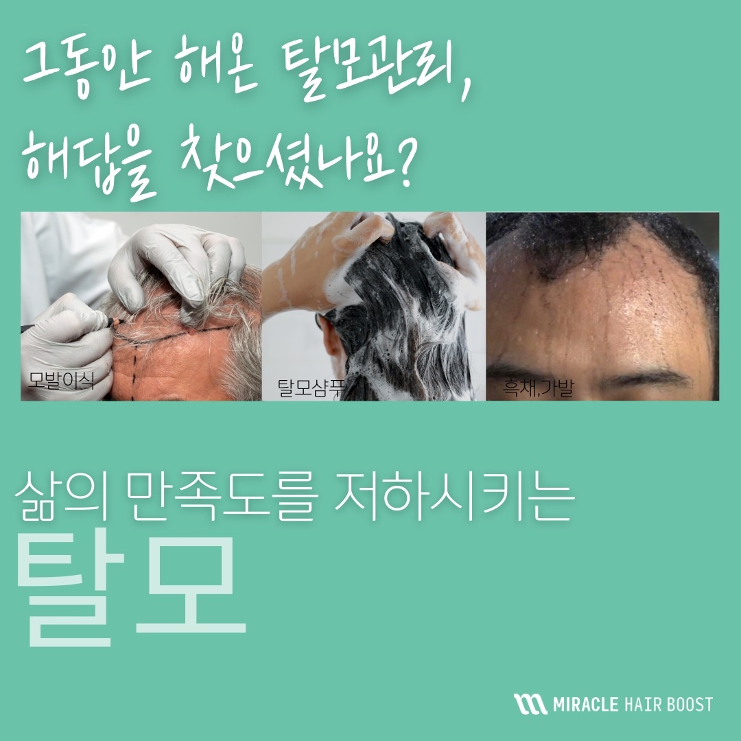 대전두피 도트바이림 picture 2