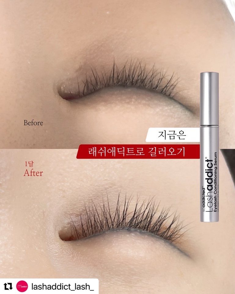 속눈썹생장제 ‘래쉬애딕트' 공식판매업체
