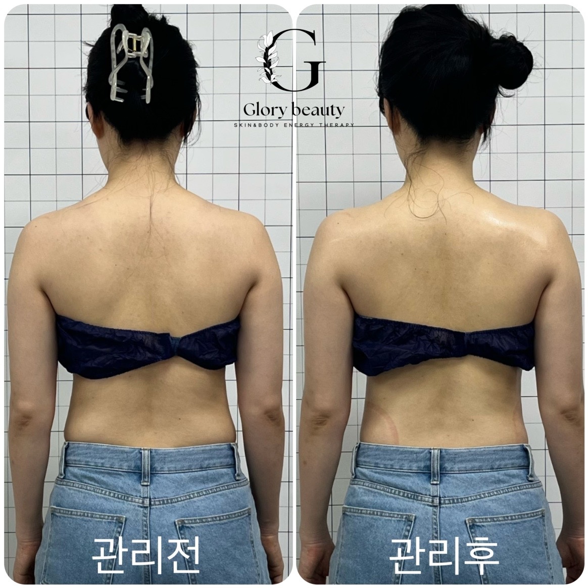 글로리뷰티 picture 6