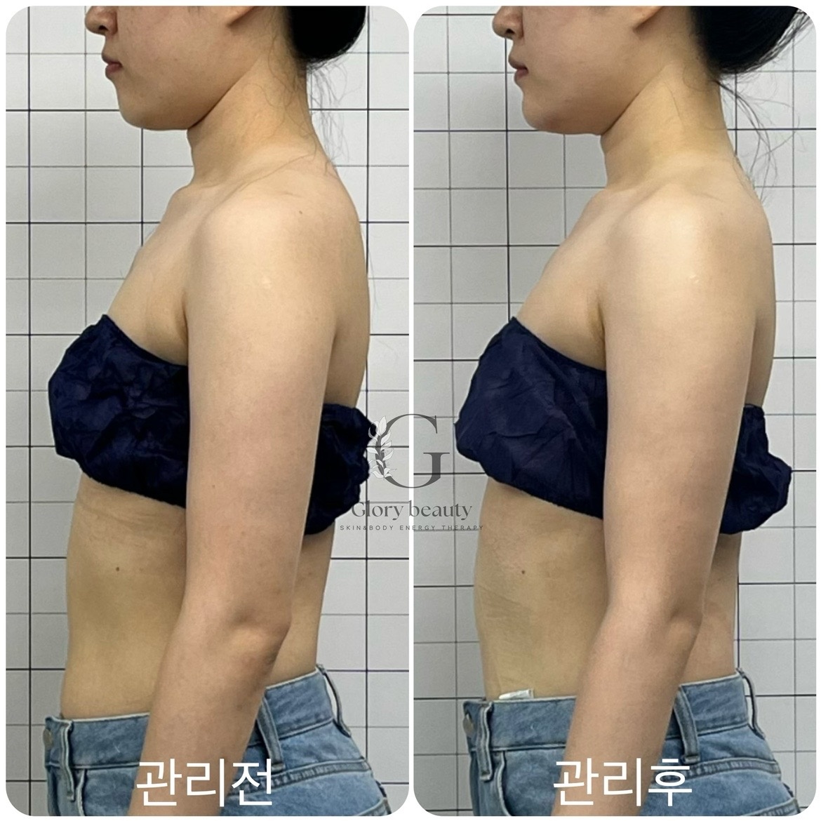 글로리뷰티 picture 7