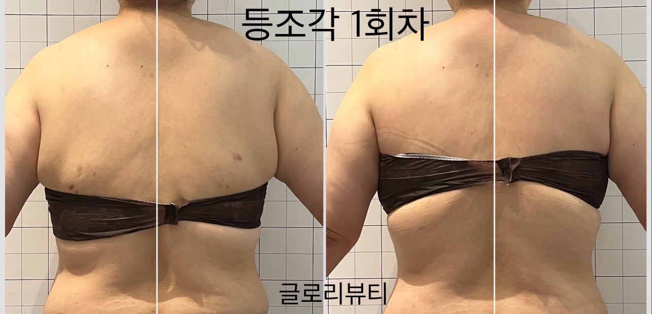 글로리뷰티 picture 9