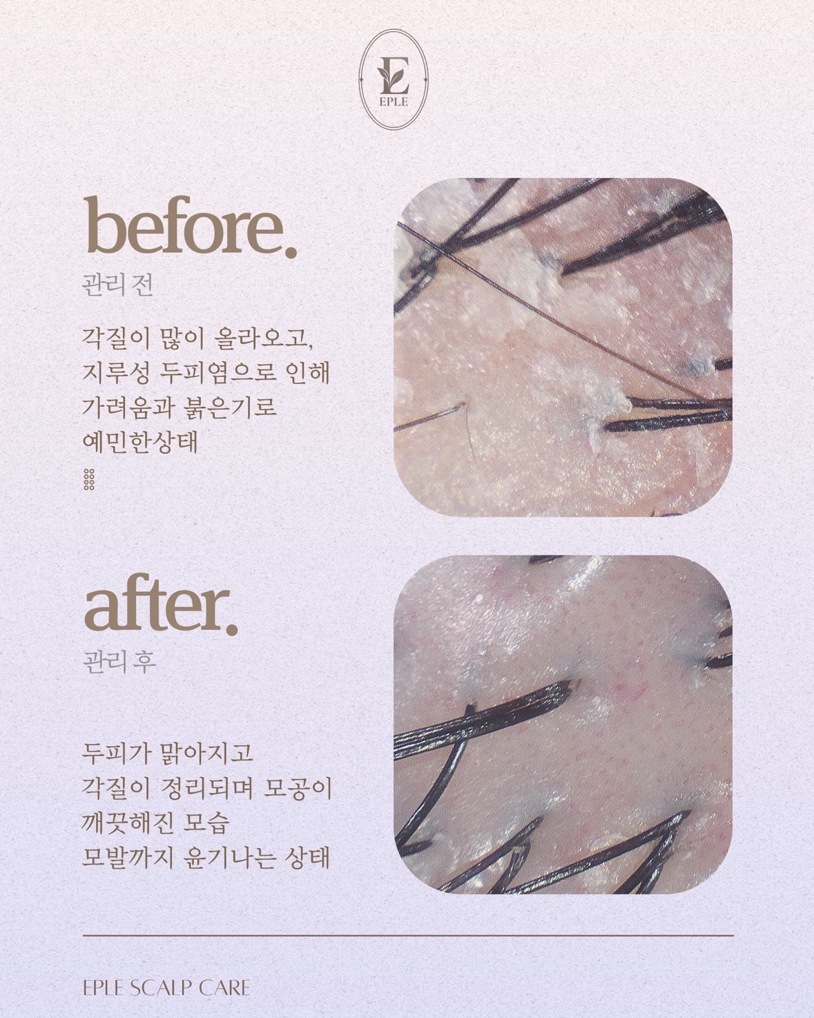 이플뷰티 picture 1