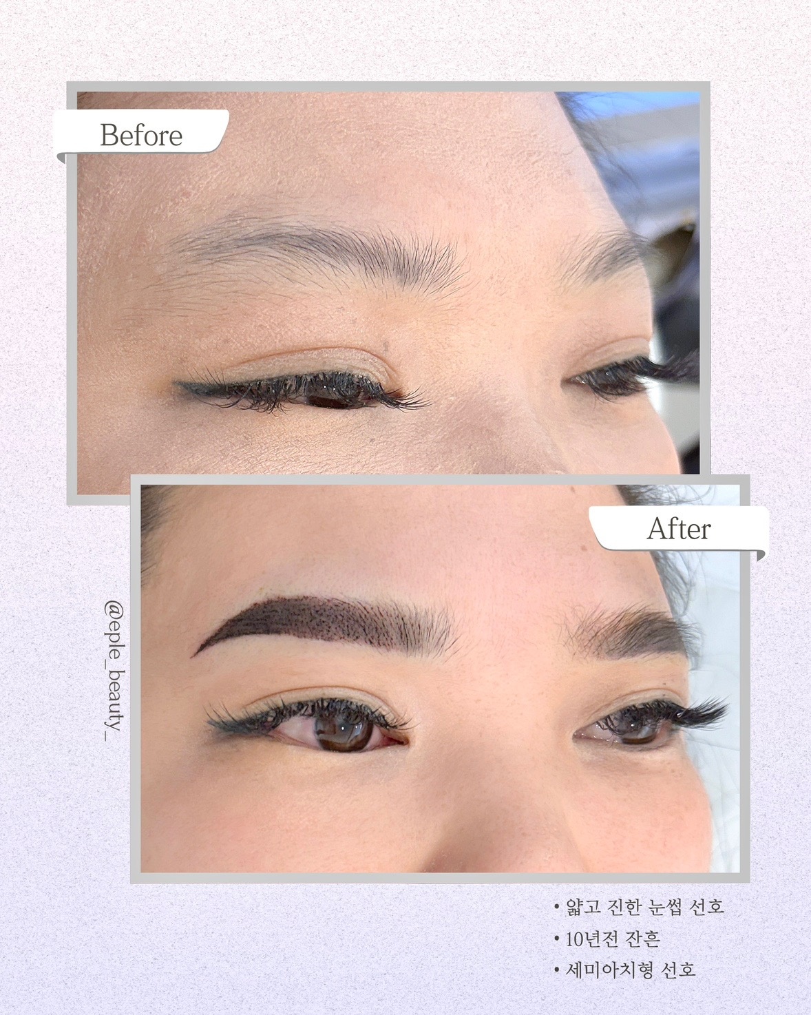 이플뷰티 picture 3