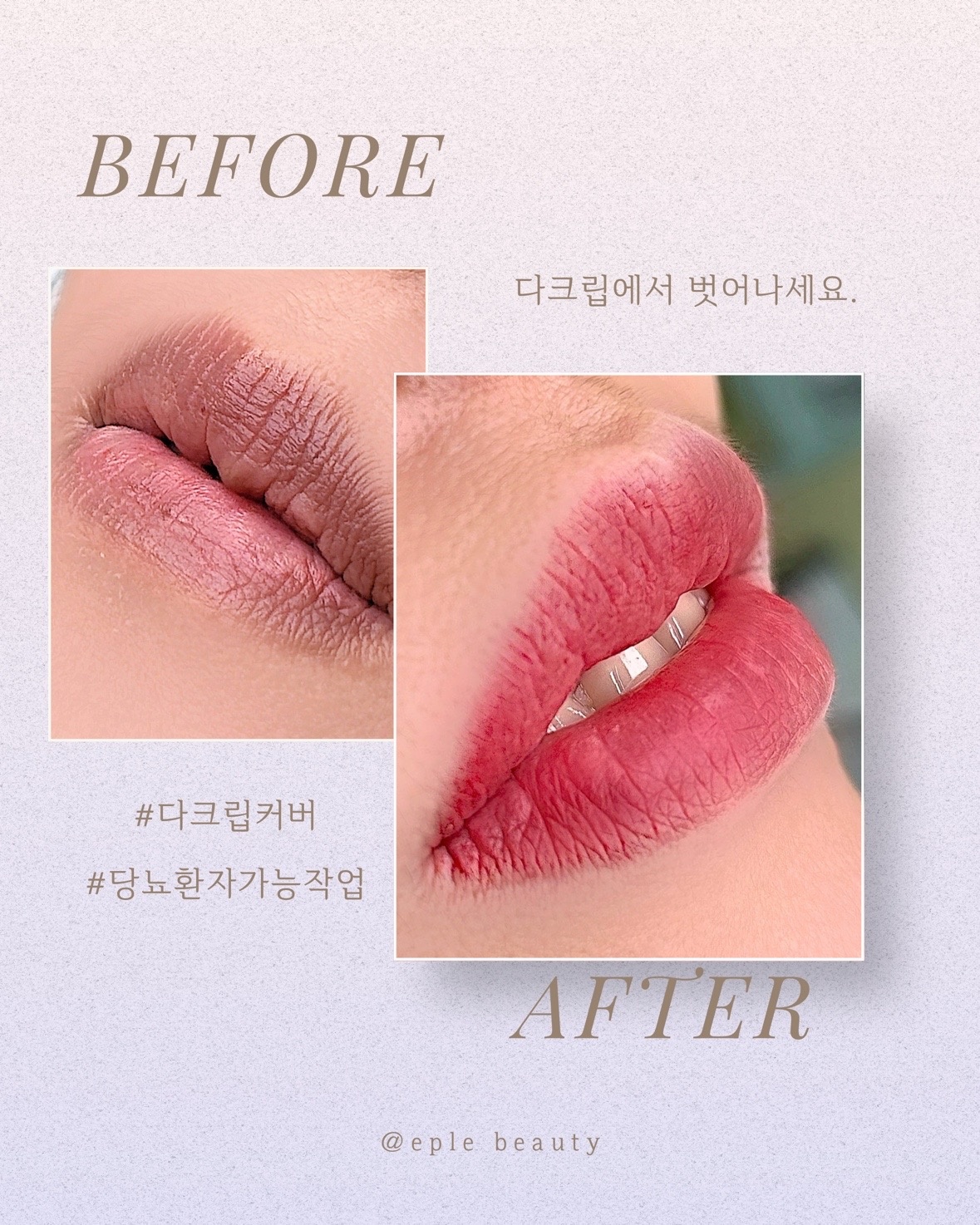 이플뷰티 picture 4