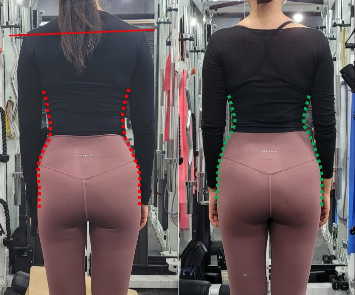 해부학적운동 군자점 picture 7