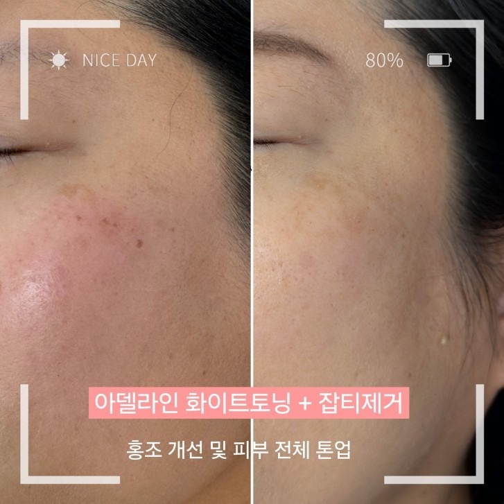 아델라인 뷰티&바디테라피 picture 2