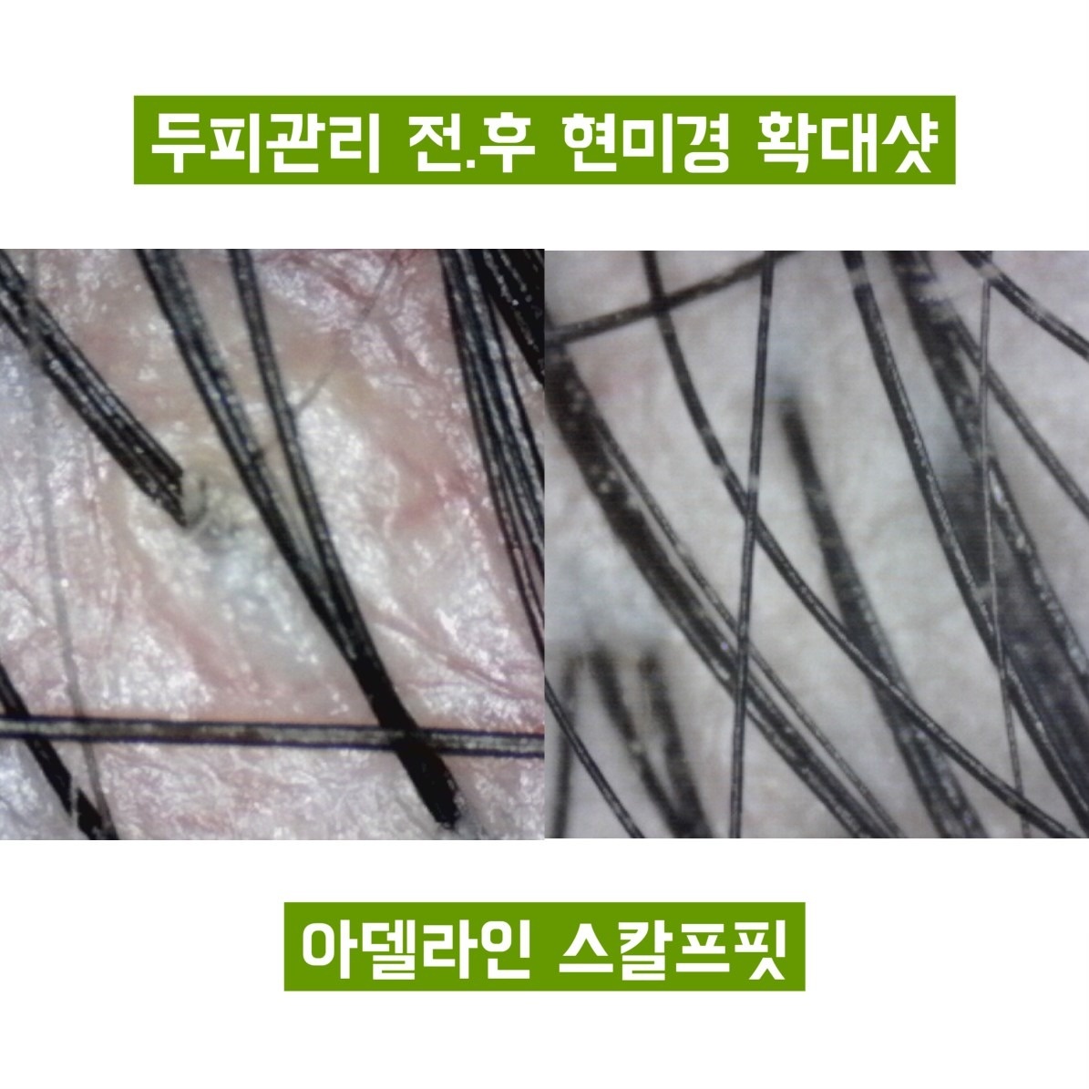 아델라인 뷰티&바디테라피 picture 8