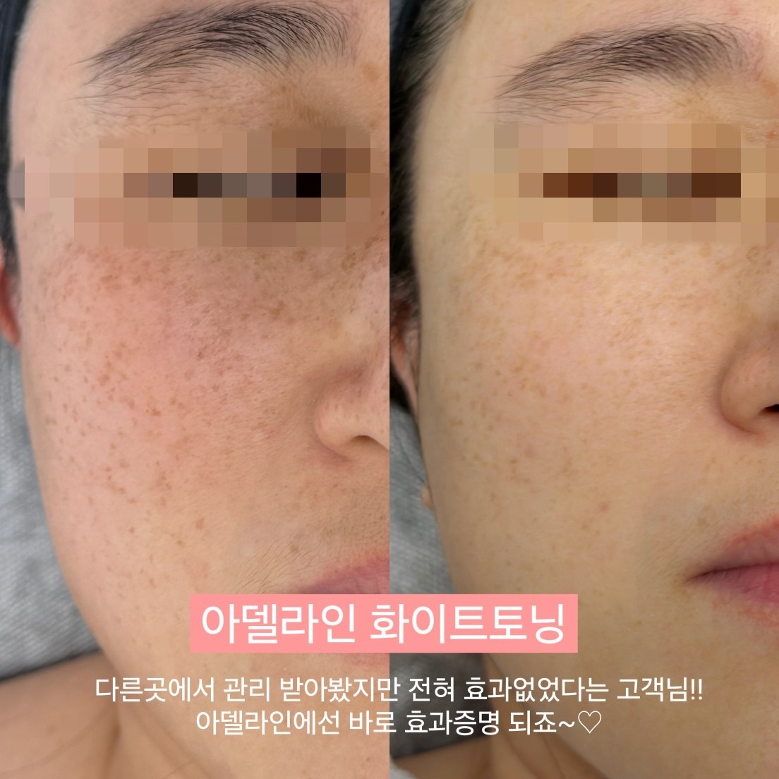 아델라인 뷰티&바디테라피 picture 3