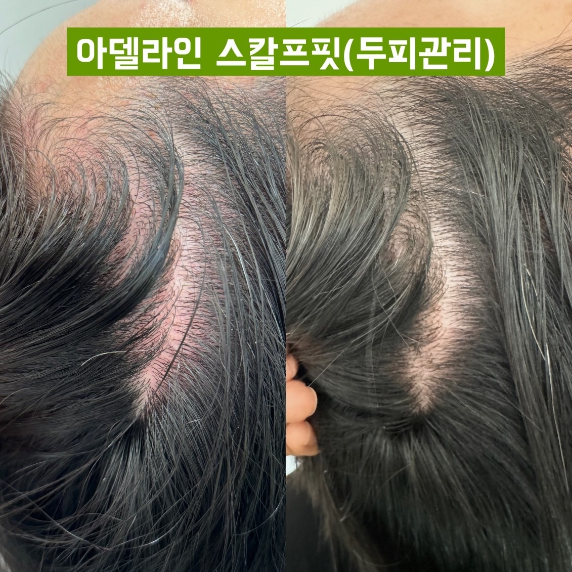 아델라인 뷰티&바디테라피 picture 7