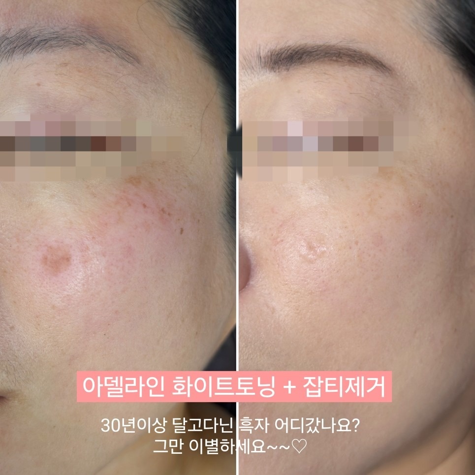 아델라인 뷰티&바디테라피 picture 5