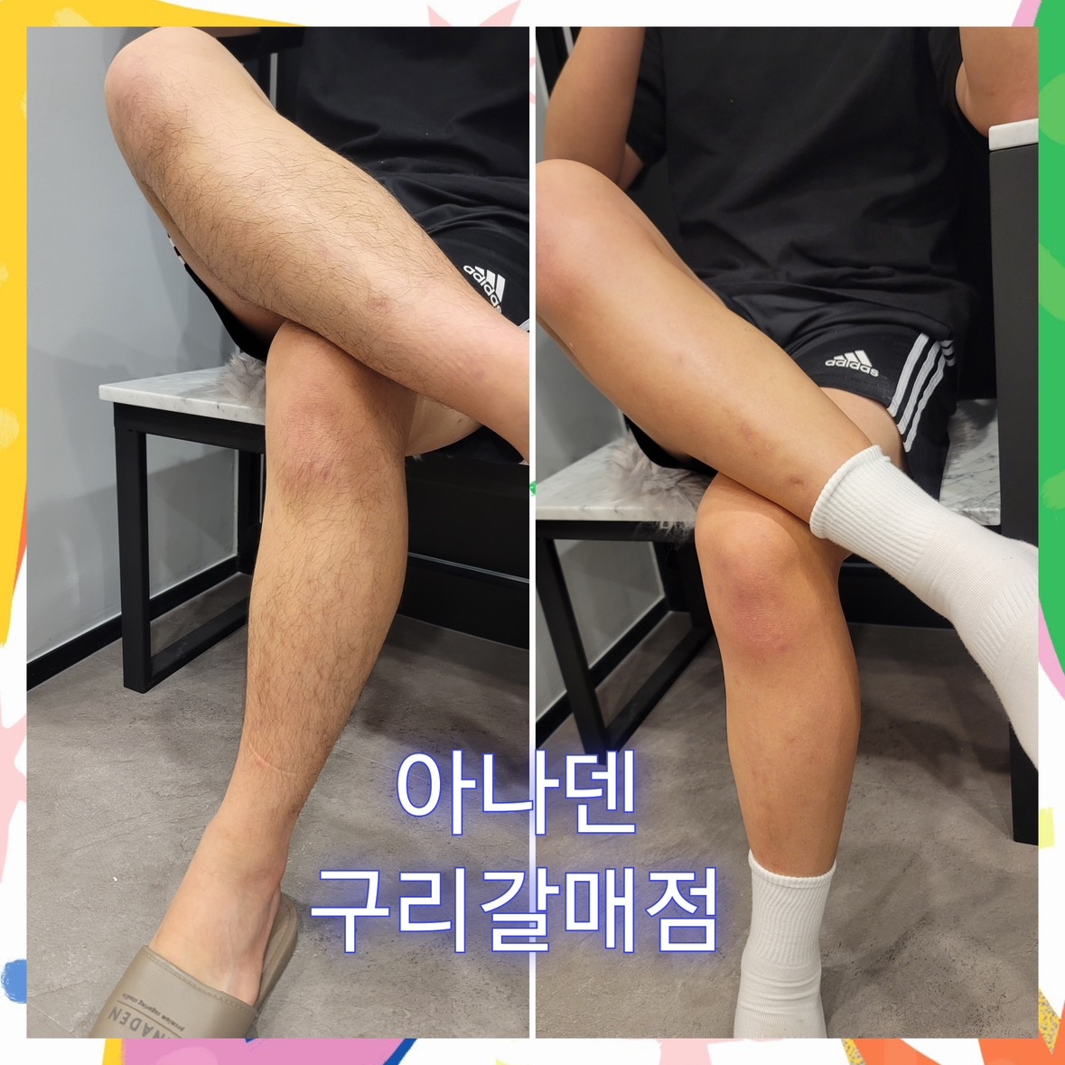 아나덴 슈가링왁싱 구리갈매점 picture 1