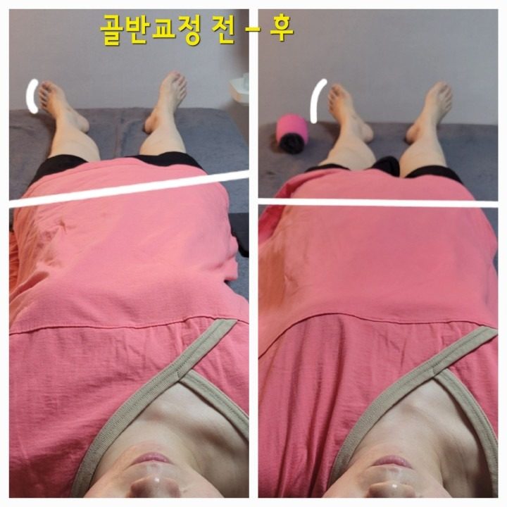 핵가성비 통증관리