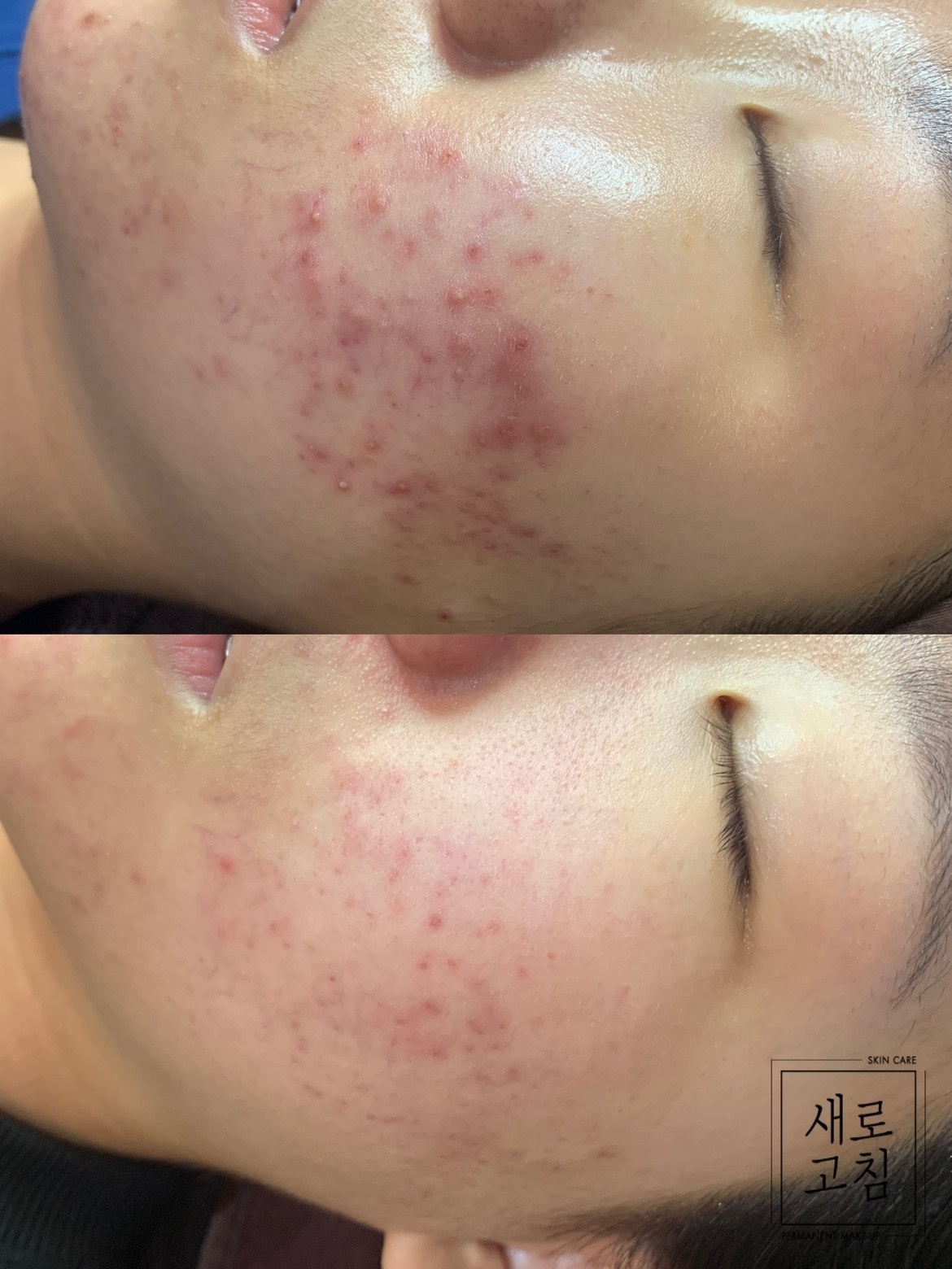 새로고침 picture 6