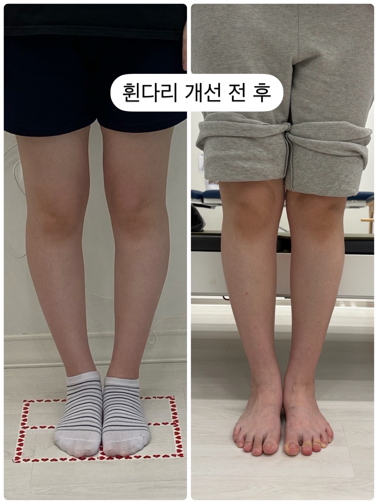 미타임 필라테스 picture 0