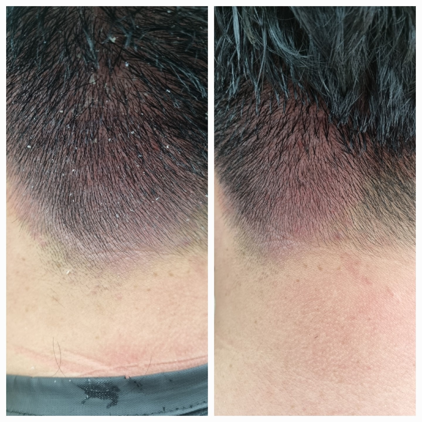 라하헤어 picture 1