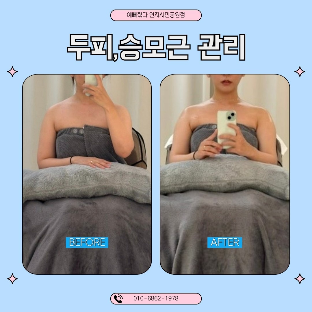 예뻐졌다 연지시민공원점 picture 0