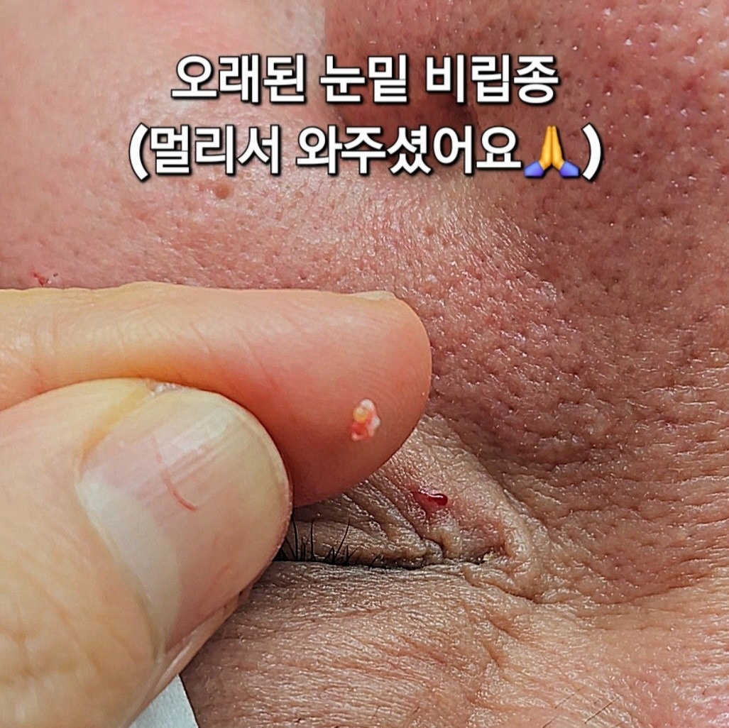 메이드스킨 picture 2