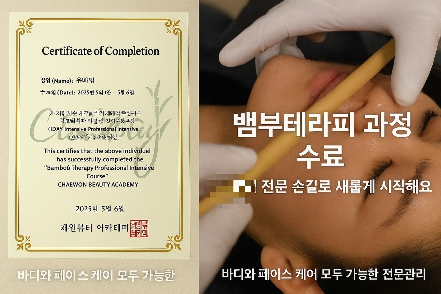 윤샵피부관리 picture 4
