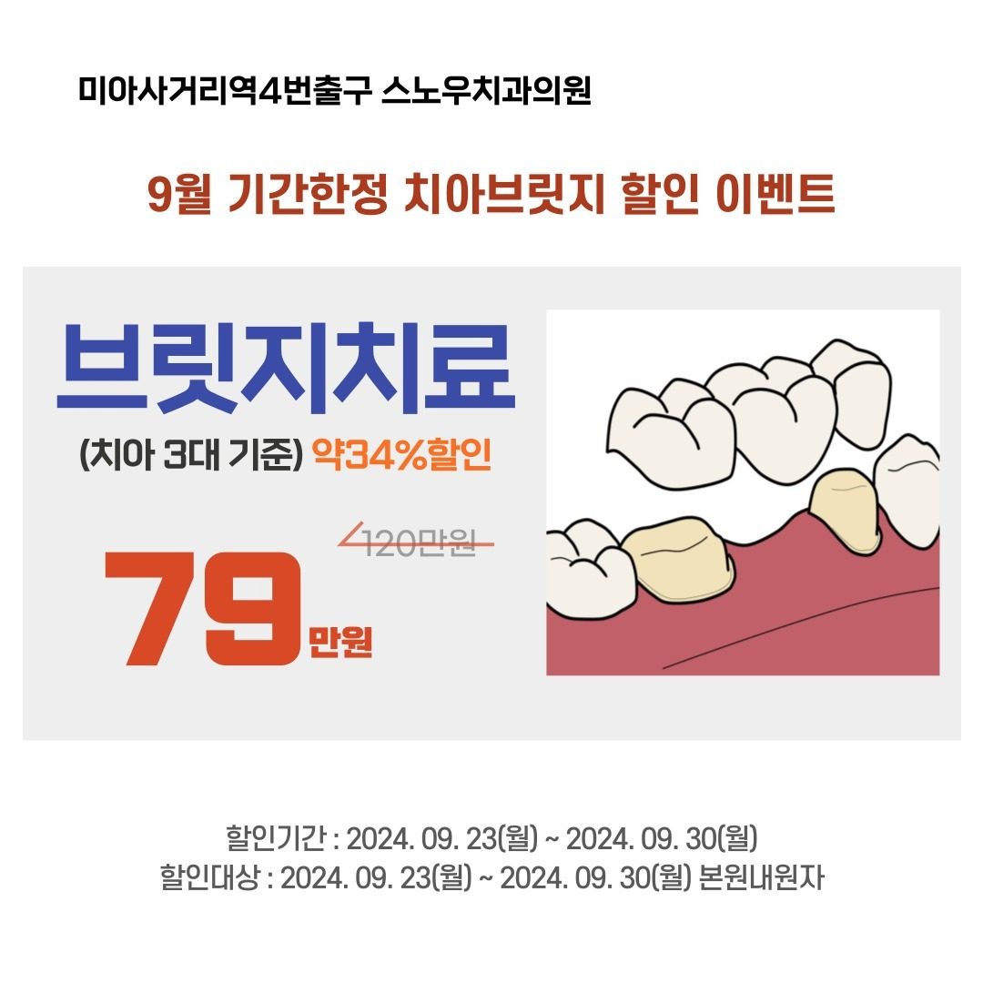 9월 기간한정 치아브릿지 가격 할인