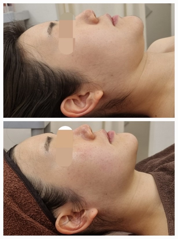 유라인에스테틱 picture 3