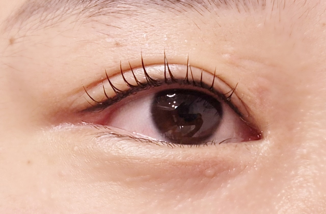 그리고. picture 0
