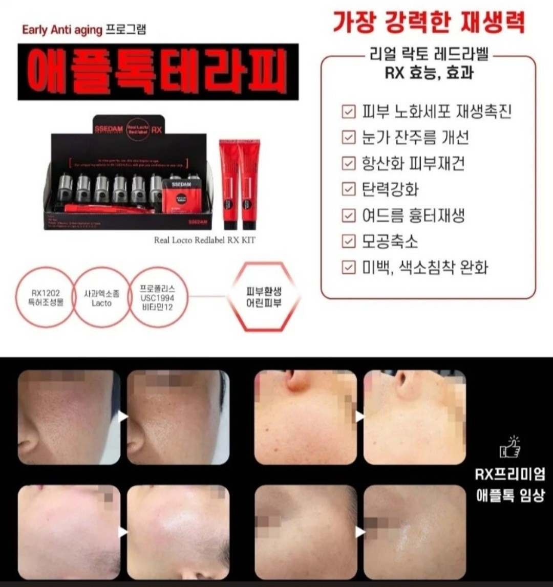 비비채움 스킨 picture 1