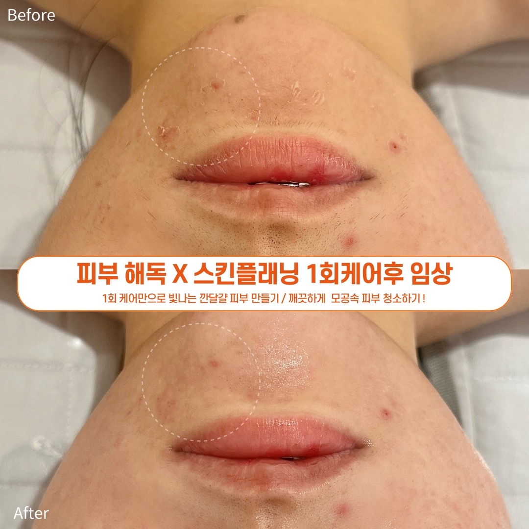 로로비비에 picture 9