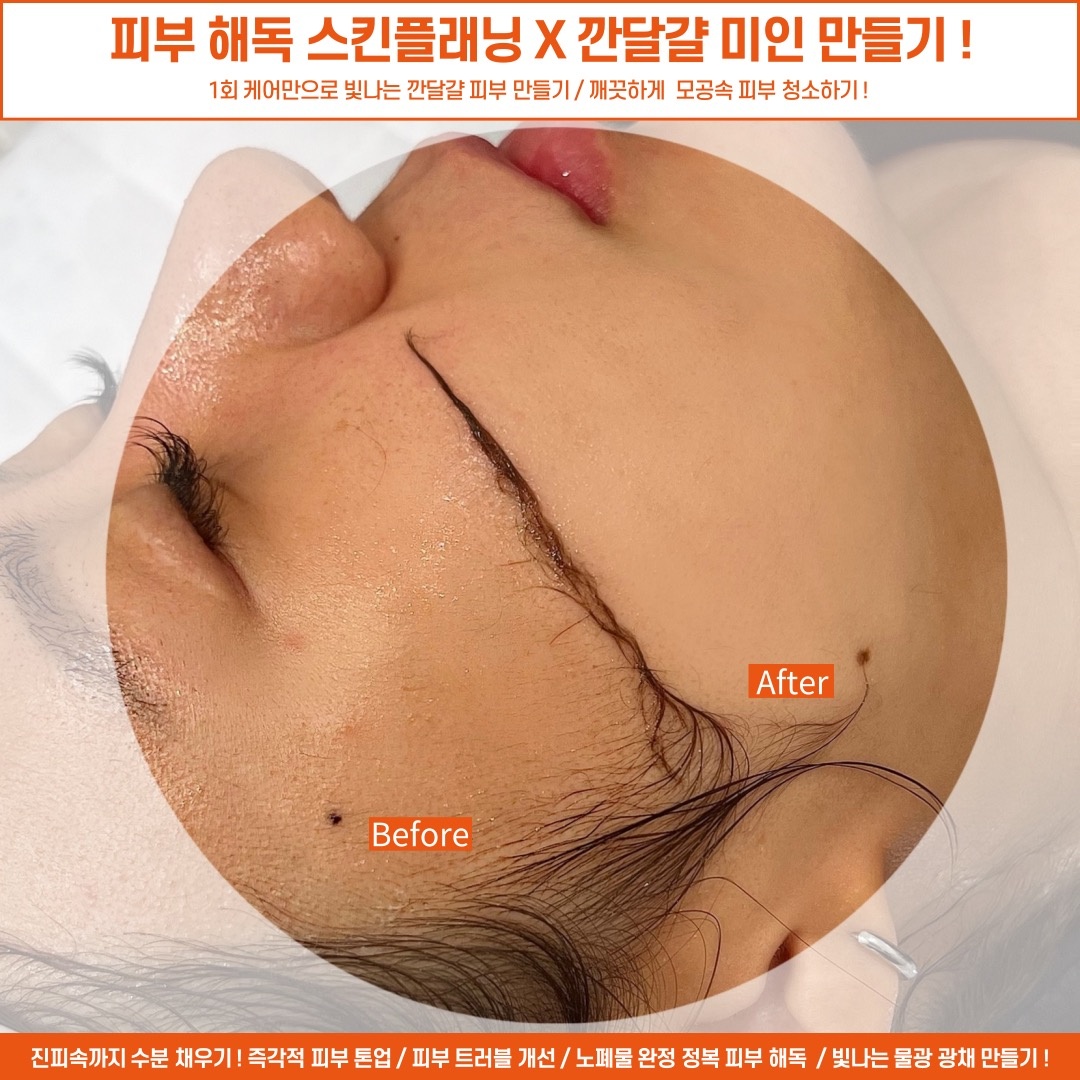 로로비비에 picture 8