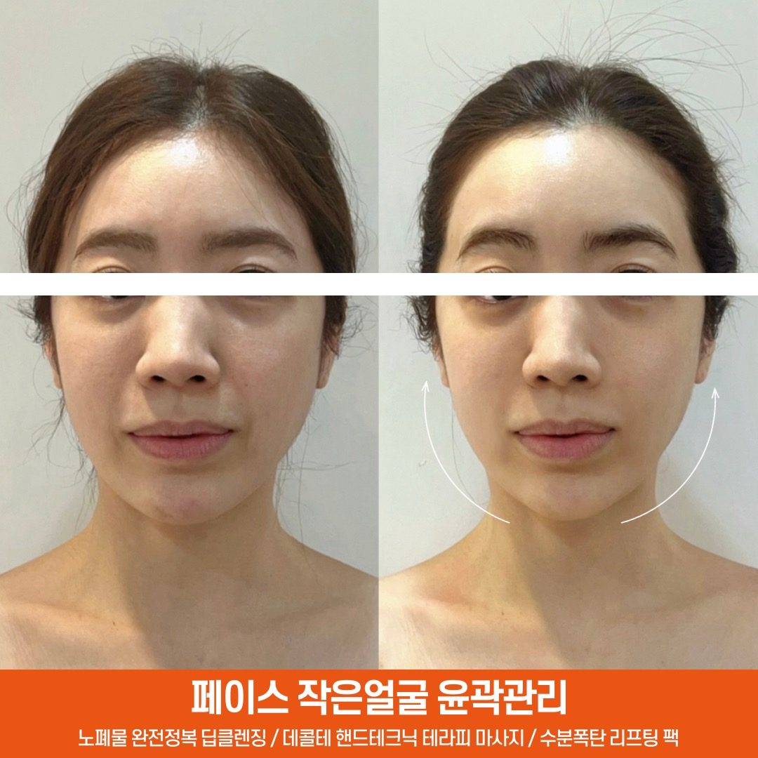 🚨예약폭주‼️윤곽리프팅💥데콜테마사지맛집🔥