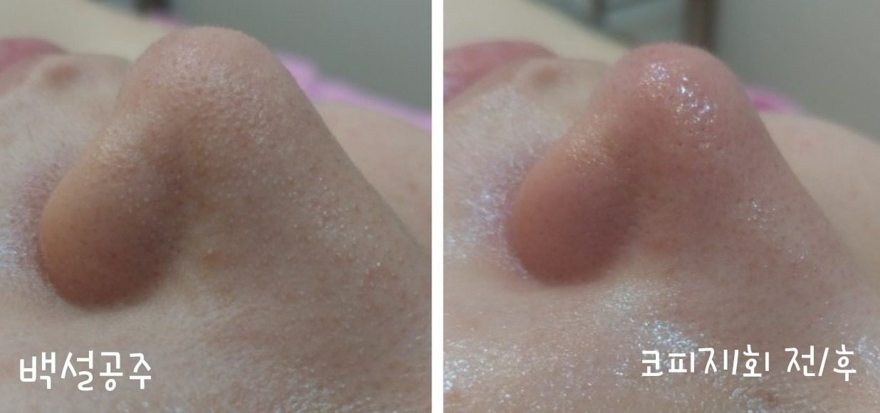 백설공주 에스테틱