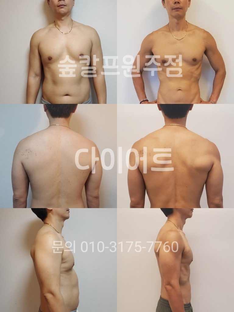 운동없이 다이어트 성공!!