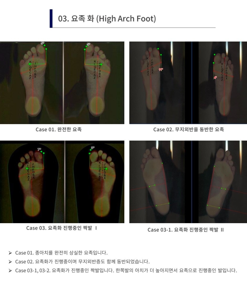 엠바디PT 근골격운동센터 방학역점 picture 6