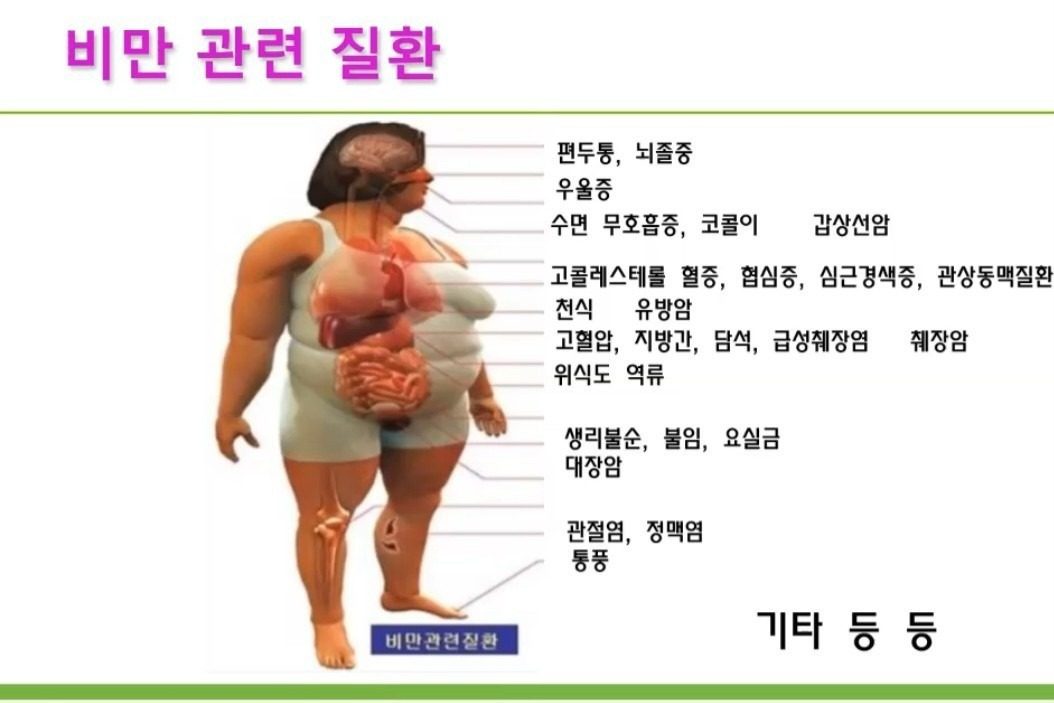 ✅️비만관련 질환 건강관리하러 오세요