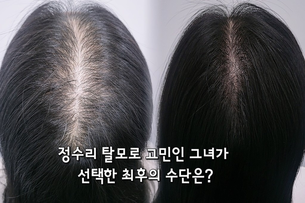 관련 이미지2