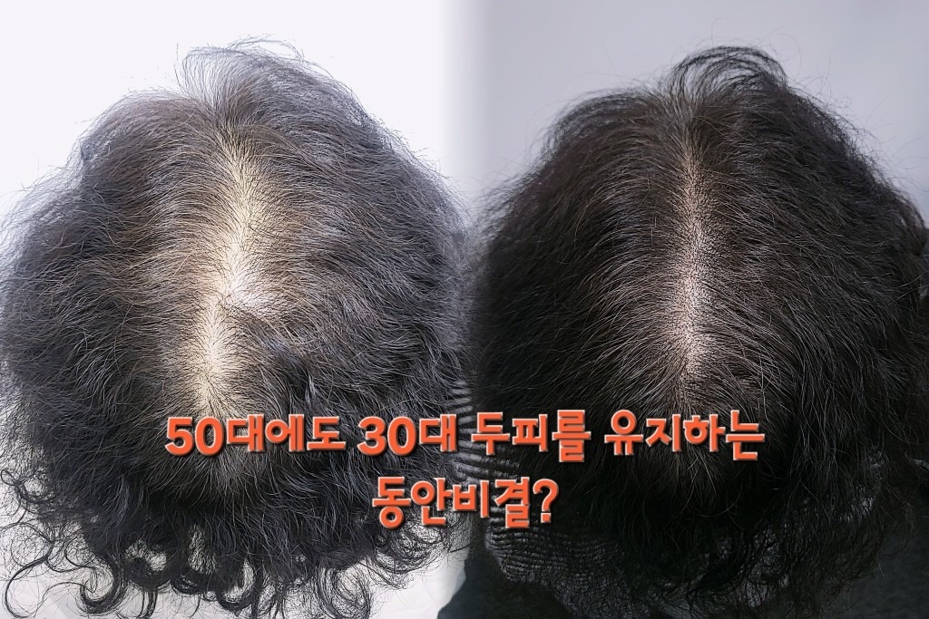 관련 이미지1