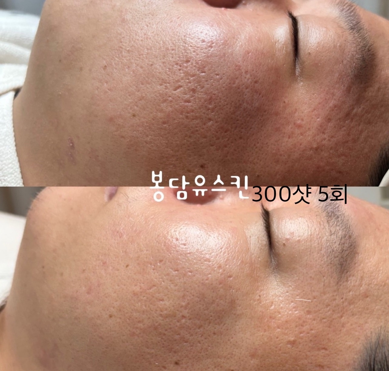 유스킨 picture 8