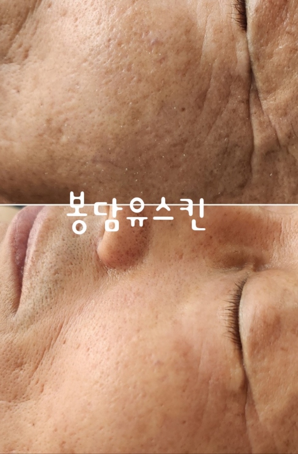 유스킨 picture 4