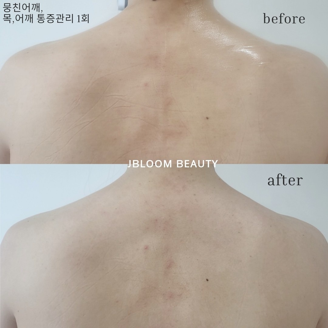 제이블룸 뷰티 picture 3