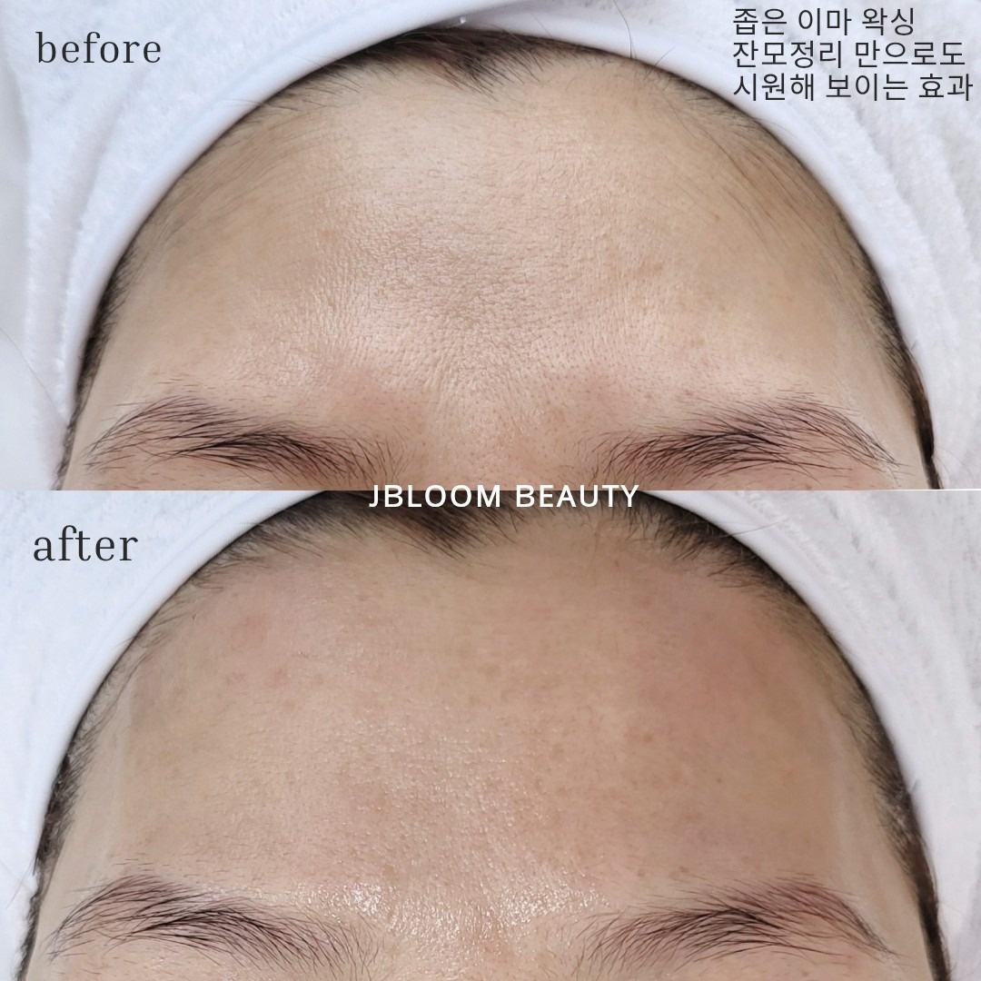 제이블룸 뷰티 picture 4
