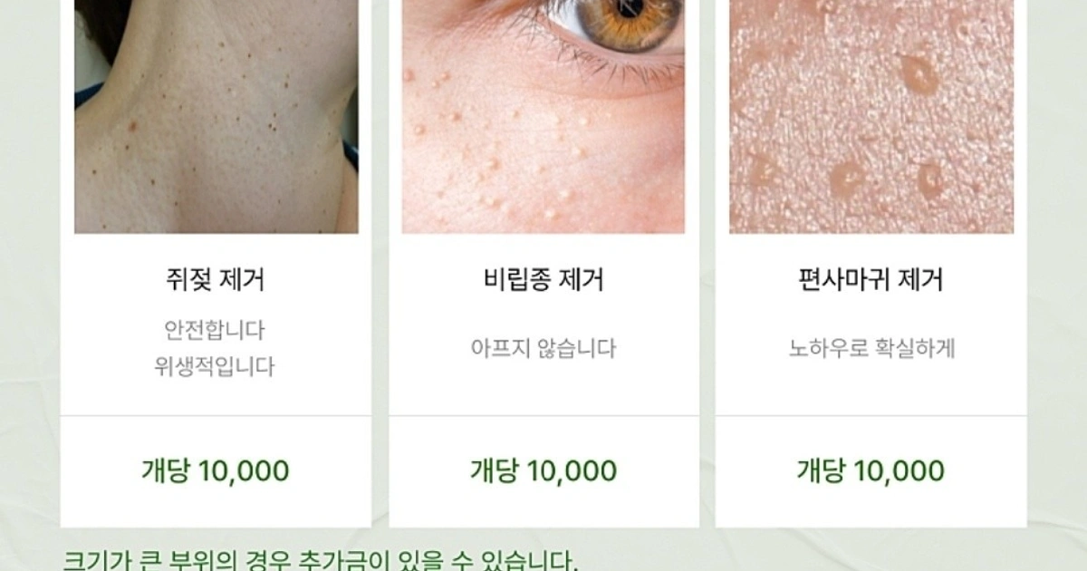 실면도 쥐젖관리 지금 꼭 받으세요.👌🏻 | 충청남도 서산시 석림동 | 속눈썹펌/연장 | 당근 비즈 소식