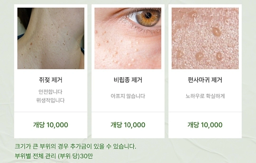 실면도 쥐젖관리 지금 꼭 받으세요.👌🏻 | 충청남도 서산시 석림동 | 속눈썹펌/연장 | 당근 비즈 소식