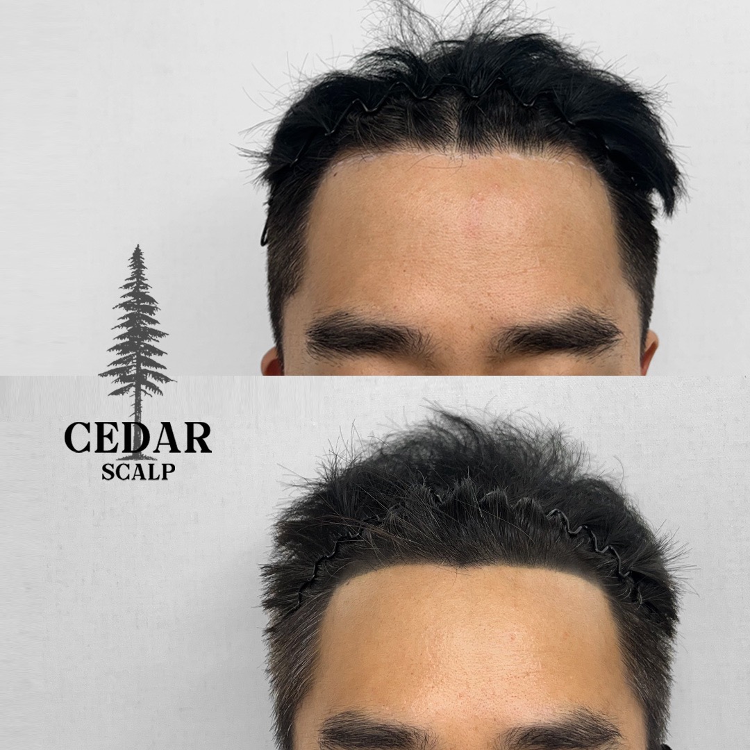 b2w4REl4Qk5naXNpaHBuVXUxVTZN.jpeg?q=95u0026s=1440x1440u0026t=inside