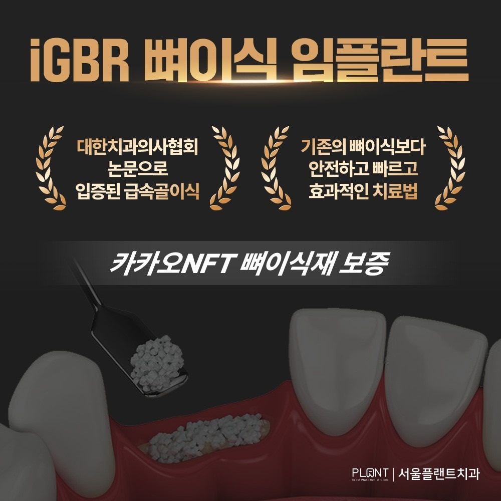 서울플랜트치과 picture 6