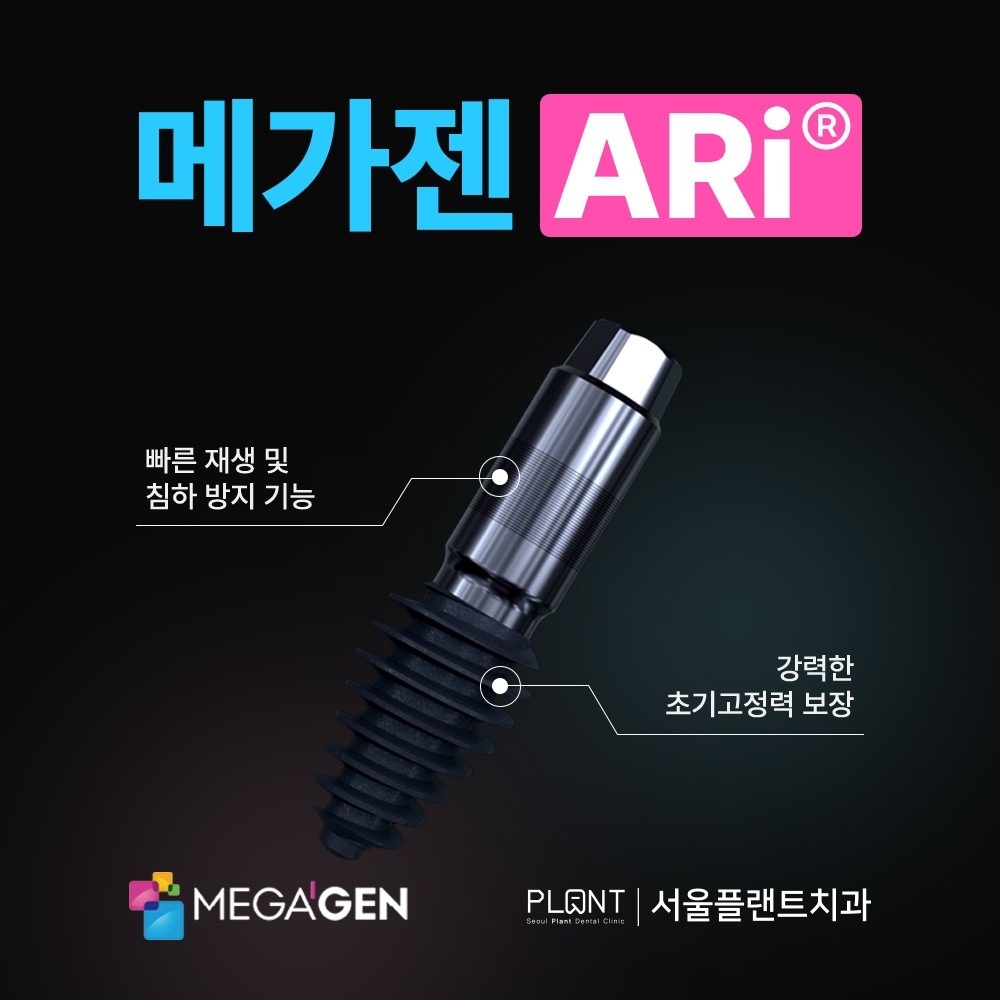 서울플랜트치과 picture 5