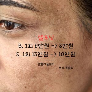 24k골드셀토닝 1회 체험가 5만원 