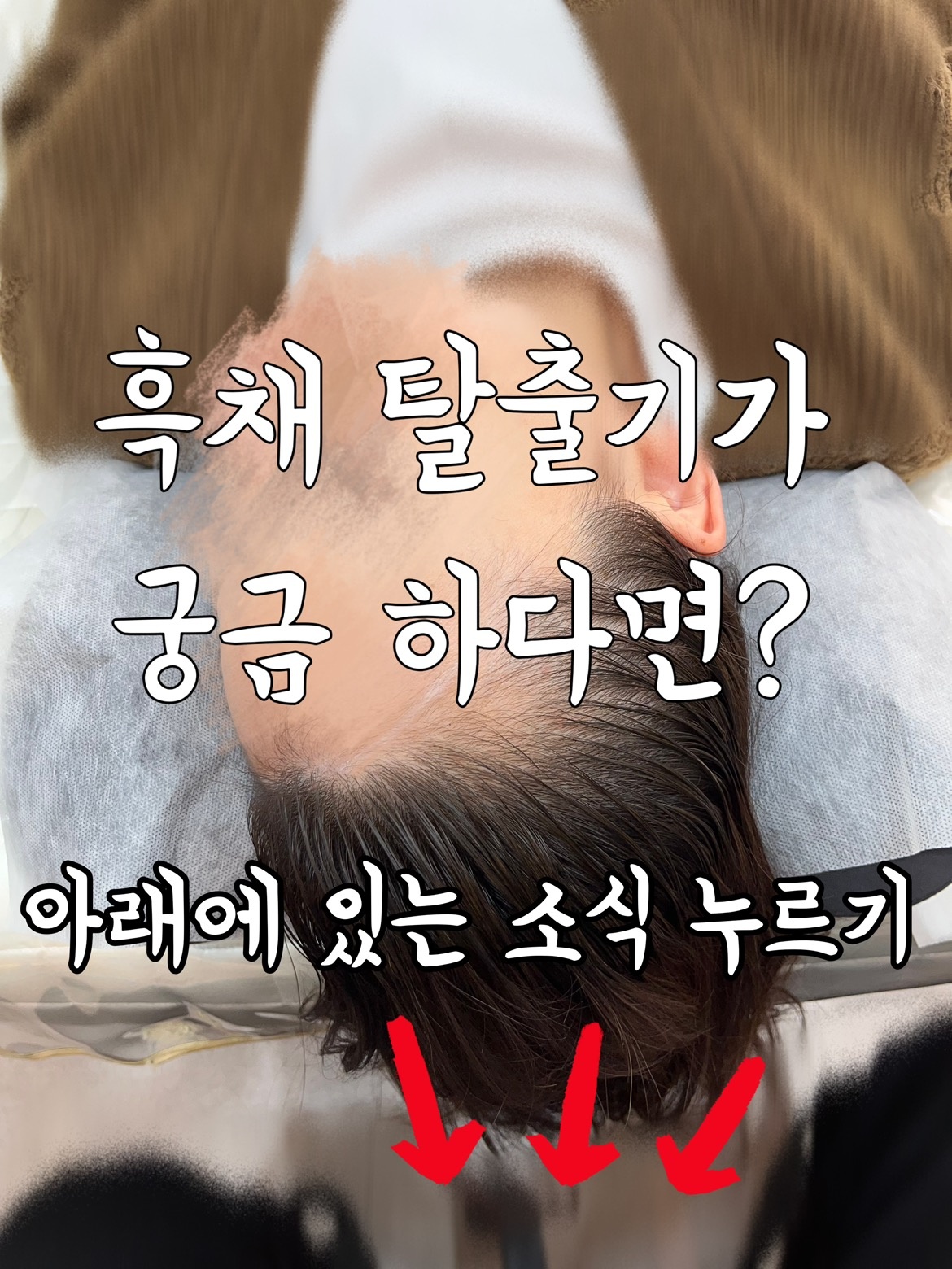 그로우앳 스칼프 picture 0