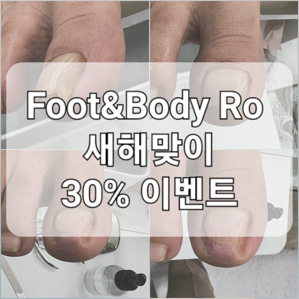 발톱스케일링 첫관리 30% 이벤트