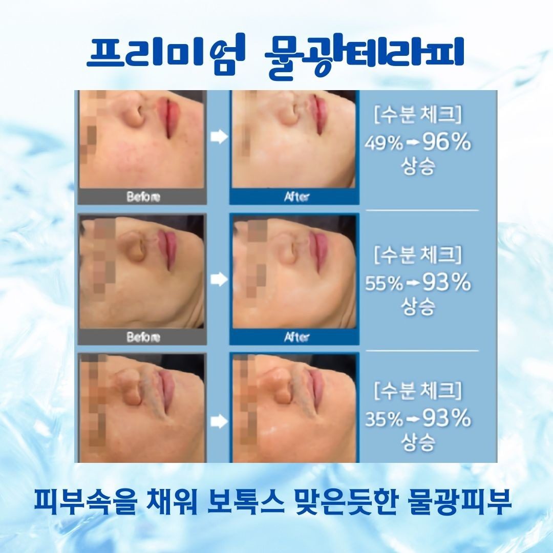 ✅️민생지원금 사용가능 ✅️휴가철 자극받은 피부 휴식처