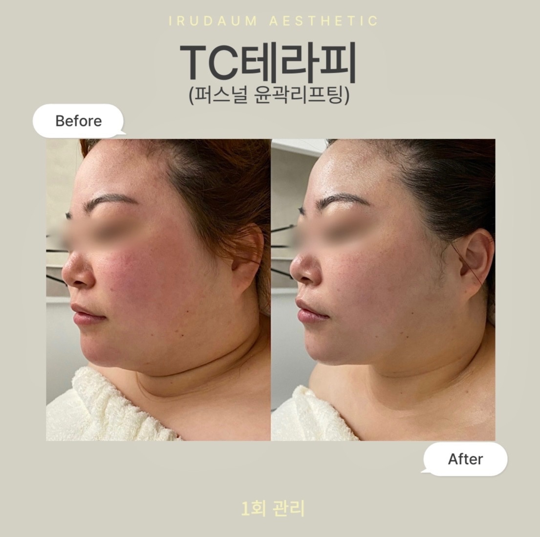 이루다움에스테틱 picture 4